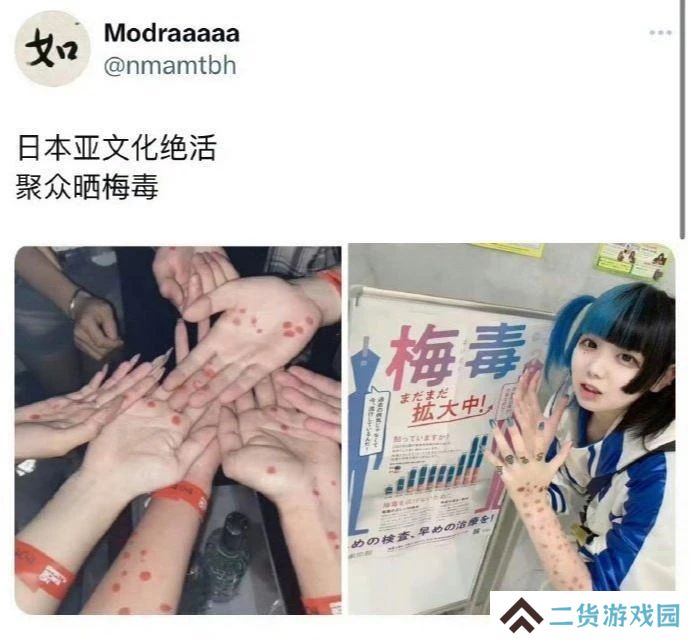 PS5涨价与小日子梅毒激增 背后潜藏着一样的逻辑